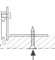 DELTA LIGHT - Spm20 - Fixation Set